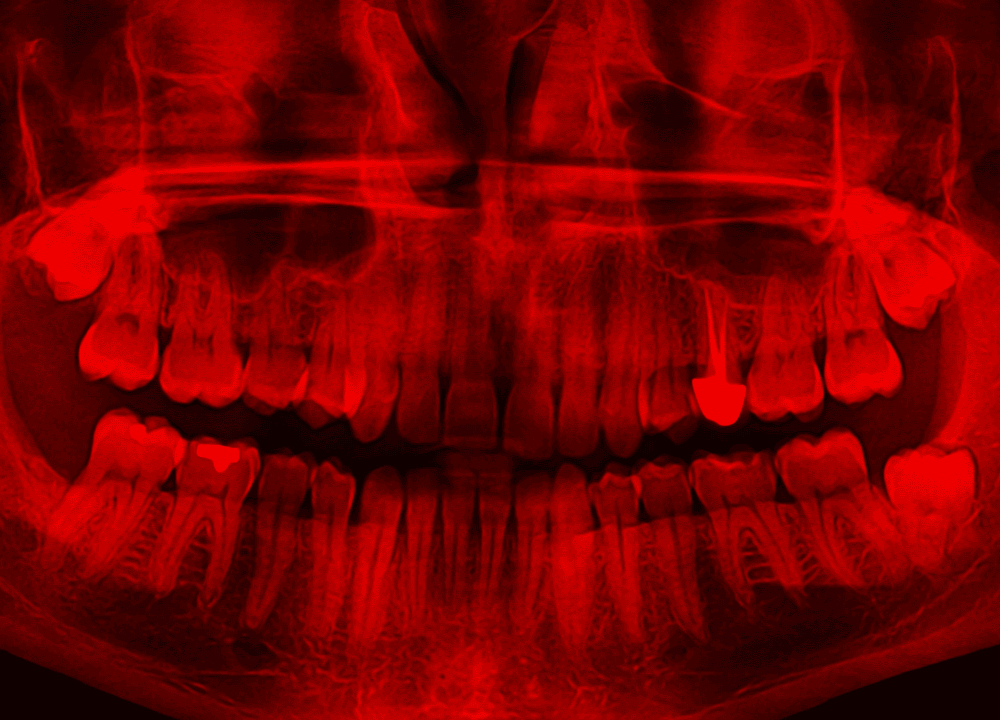 Nagy dobások és könnyed hallgatások az év elején
